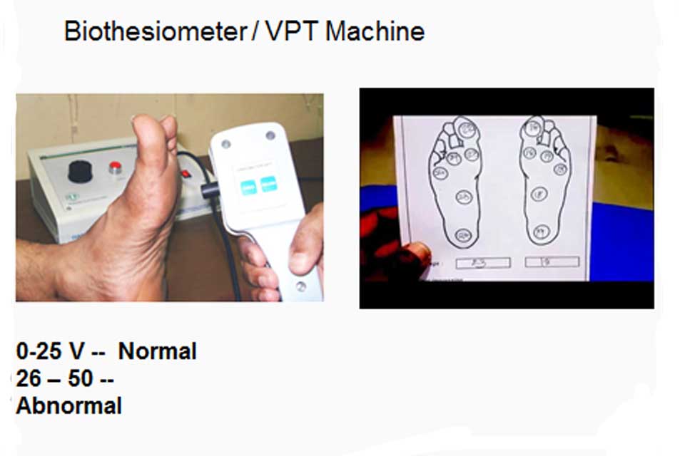 Biothesiometer/VPT Machine
