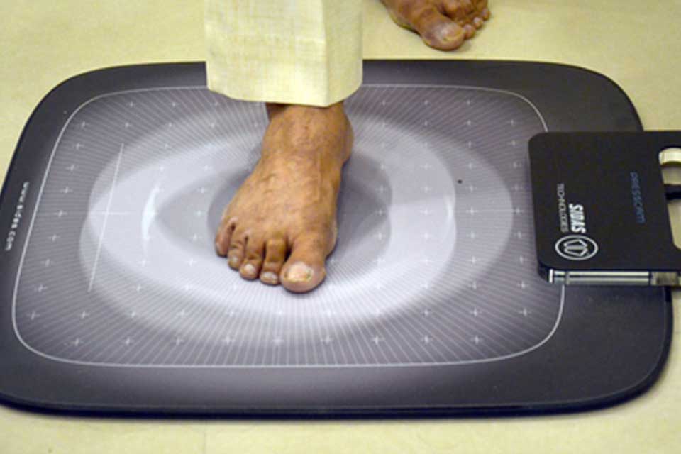 Foot Pressure Assessment: Foot Scan