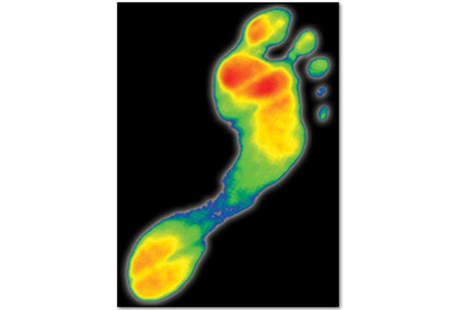 Foot Pressure Assessment: Foot Scan